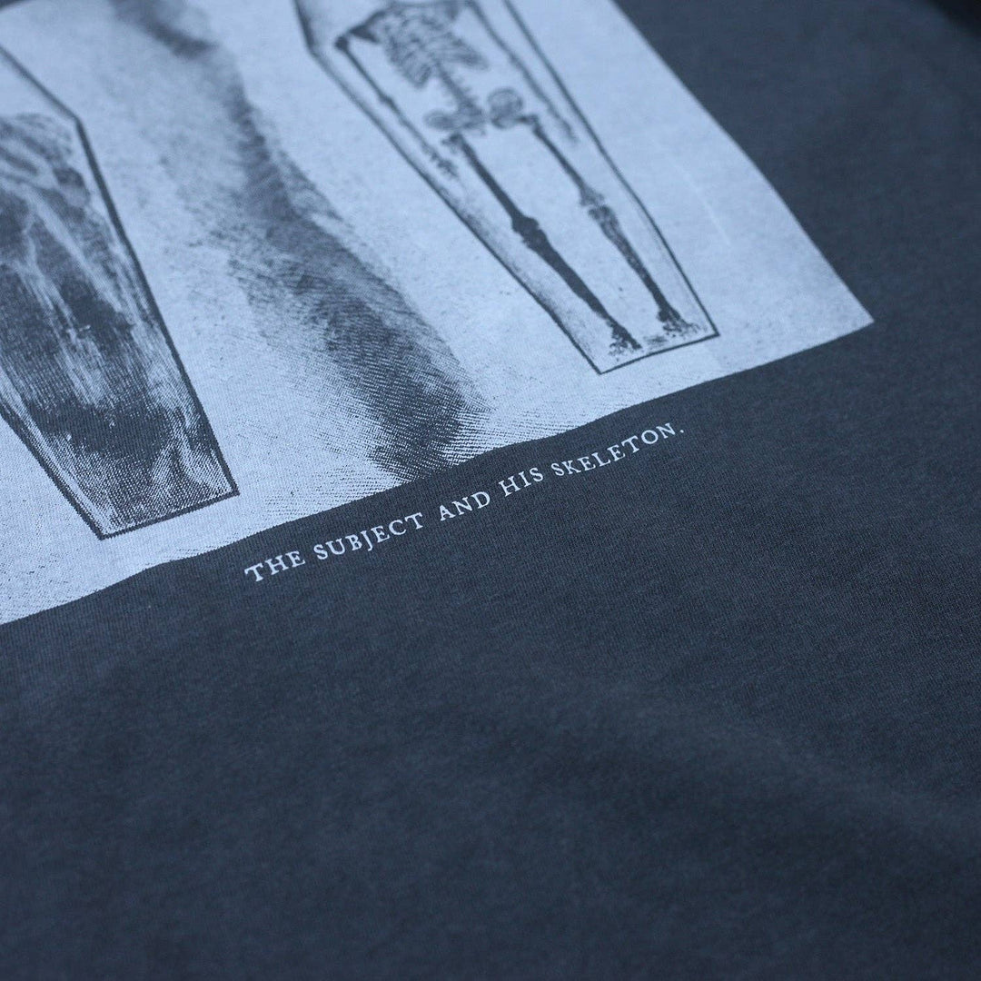 The Subject and His Skeleton Tee