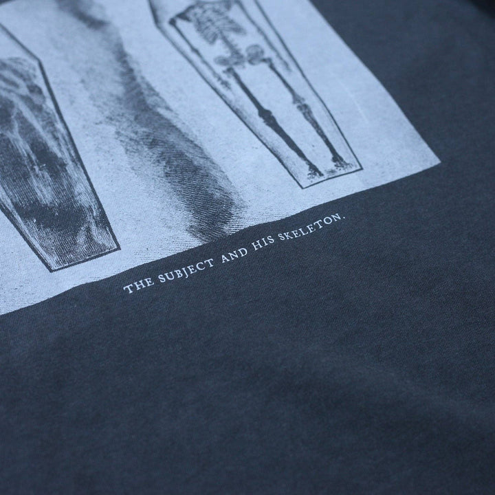 The Subject and His Skeleton Tee