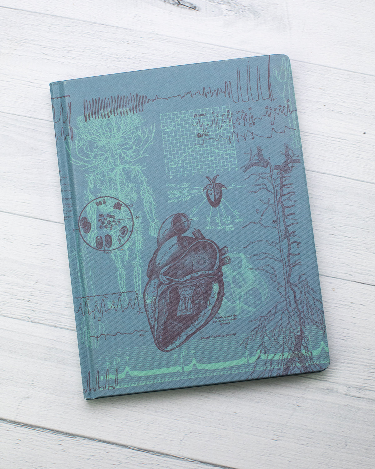 Cardiology Journal